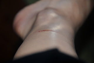 A reminder of my incompetence. Yup...rope burn.